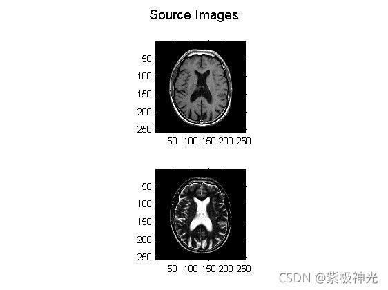 基于matlab对比度和结构提取的多模态解剖图像融合实现